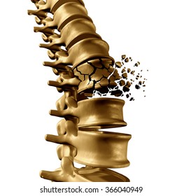 Spinal Fracture And Traumatic Vertebral Injury Medical Concept As A Human Anatomy Spinal Column With A Broken Burst Vertebra Due To Compression And Osteoporosis Back Disease On A White Background.