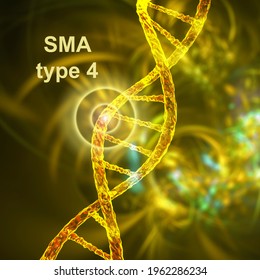 Spinal Muscular Atrophy, SMA, Type 4, A Genetic Neuromuscular Disorder With Progressive Muscle Wasting Because Of Loss Of Motor Neurons Due To Mutation In The SMN1 Gene, Conceptual 3D Illustration