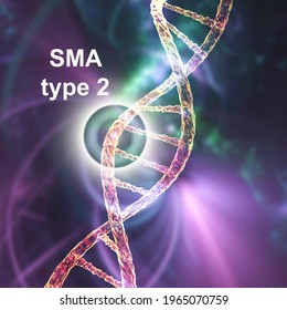 Spinal Muscular Atrophy, SMA, Type 2, A Genetic Neuromuscular Disorder With Progressive Muscle Wasting Because Of Loss Of Motor Neurons Due To Mutation In The SMN1 Gene, Conceptual 3D Illustration