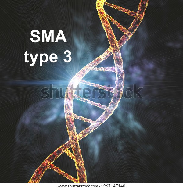 spinal muscular atrophy type 3