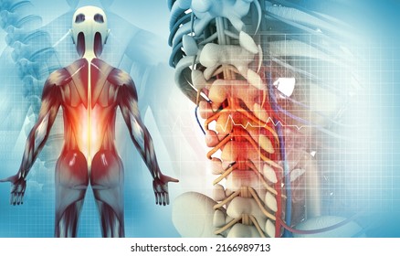 Spine cancer or spinal disease, 3d illustration - Shutterstock ID 2166989713