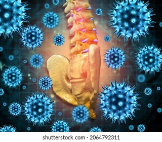 Spine Cancer Or Spinal Tumor Disease.3d Illustration