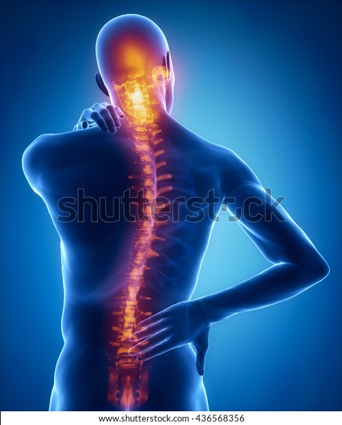 Spine\
injury pain in sacral and cervical region\
concept