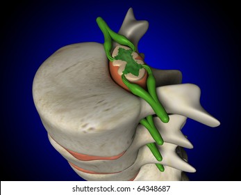 Spine, Spinal Cord And Nerves