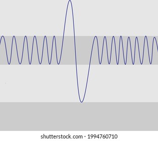 Spirometry Curve Analyses. Illustration Of Spirometry Curves.