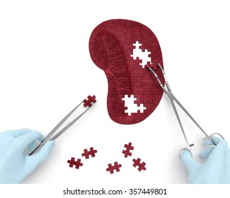 Spleen Puzzle Concept: Hands Of Surgeon With Surgical Instruments (tools) Performs Spleen Surgery As A Result Of Splenomegaly, Splenic Infarction, Megalosplenia, Splenelcosis, Splenitis, Anemia, Cysts