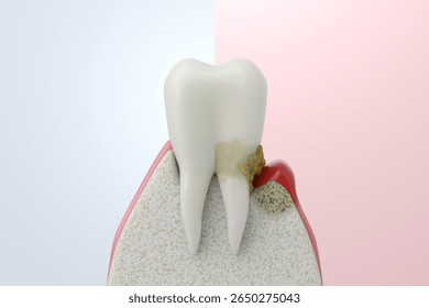 split screen comparison between healthy teeth and gums and teeth with advanced periodontitis. 3D illustration.