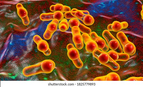 Gas Gangrene Images Stock Photos Vectors Shutterstock