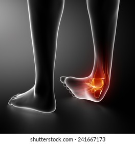 Sprained ankle black x-ray