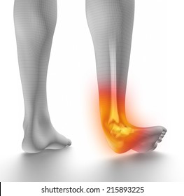 Sprained Ankle On White Stock Illustration 215893225 | Shutterstock