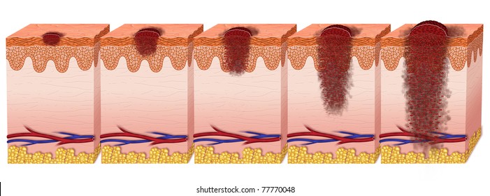 Stadiums Of Melanoma