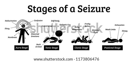Stages and phases of a seizure. Illustrations depicts the phases when a person get a seizure which are the aura, tonic, clonic, and postictal stages.
lose  Stock photo © 