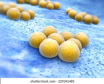 Staphylococcus Aureus (MRSA)