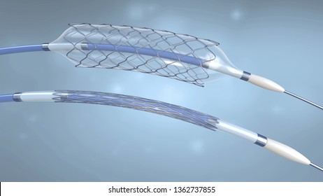 Stent and catheter for implantation into blood vessels with an empty and filled balloon - 3d illustration