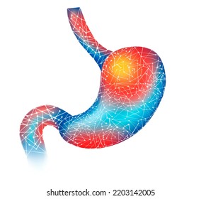 Stomach 3d Illustration Blue Illustration With Red Damage Isolated On White Background. Chronic Erosive Stomach Inflammation. Unhealthy Internal Organ. The Concept Of Diet, Intestinal. 3D Illustration