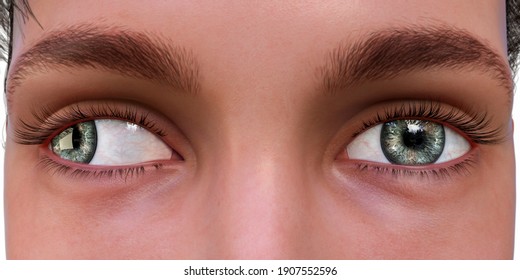 Exotropia Images Stock Photos Vectors Shutterstock