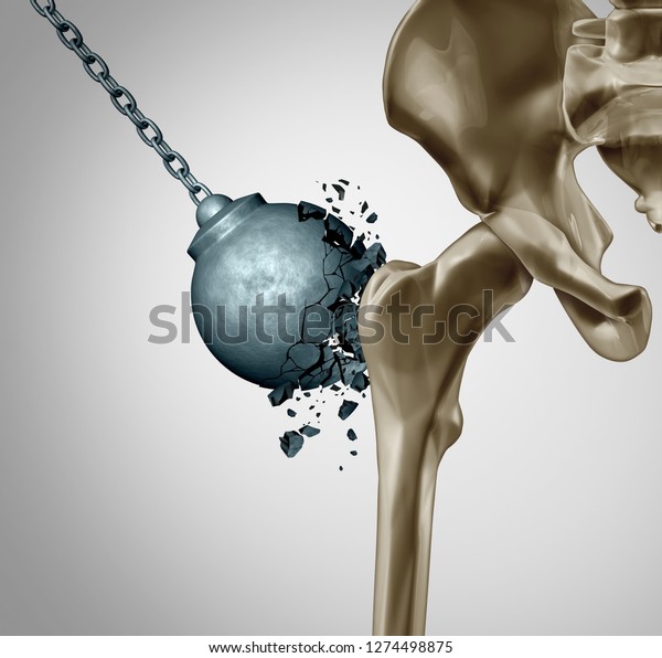 Strong bones and healthy human bone\
orthopedics and strength in mineral density medical concept as a\
wrecking ball destroyed by osteoporosis prevention medicine symbol\
as 3D\
illustration.