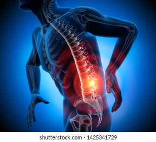 Strong Pain In Spine - 3D Illustration