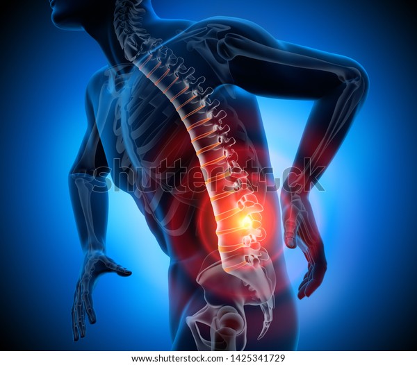 Strong pain in spine - 3D\
illustration