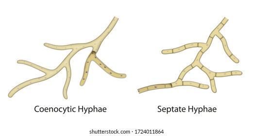 The structure of a fungal hyphae. Coenocytic Hyphae, Septate Hyphae