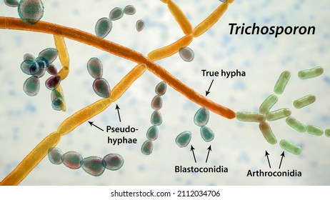 Structure of fungi Trichosporon, 3D illustration shows septate hyphae, pseudohyphae, blastoconidia singly or in short chains, arthroconidia. Cause white piedra, superficial and invasive infections