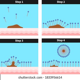 Surfactant removing dirt from skin surface, surfactants, soap, solution, detergent, hydrophilic, hydrophobic, molecule, micelle, formation, Cross sectional view 