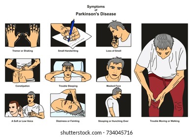 Symptoms of Parkinson’s Disease infographic diagram including tremor shaking small handwriting loss of smell constipation dizziness stooping and more for medical science education and health care - Powered by Shutterstock