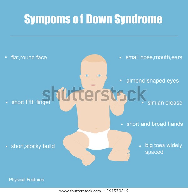 Symptoms Down Syndrome Posterillustration Little Boy Stock Illustration ...