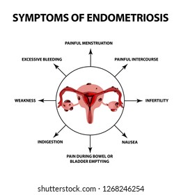 Symptoms Of Endometriosis. The Uterus Ovaries Structure. Infographics. Illustration On Isolated Background