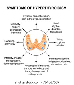 852 Hyperthyroidism symptoms Images, Stock Photos & Vectors | Shutterstock