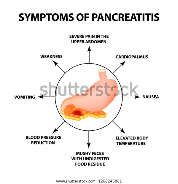 Symptoms Pancreatitis Structure Stomach Pancreas Infographics Stock ...