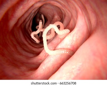Tapeworm in human intestine. 3D rendering.
Tapeworms are a species of parasitic flatworms. They live in the digestive tracts of vertebrates.

