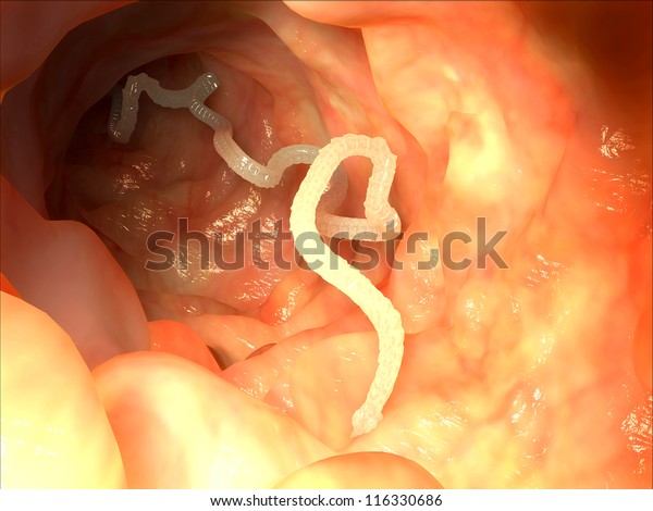 Tapeworm in human\
intestine