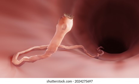 Tapeworm in the intestine, 3d illustration