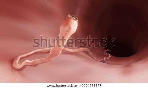 Tapeworm in the\
intestine, 3d\
illustration