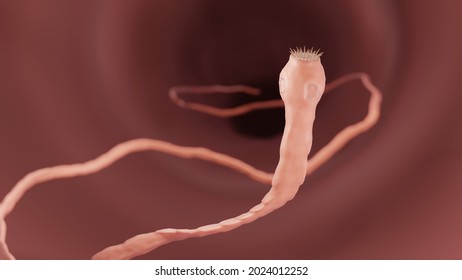 Tapeworm, Parasitic infection 3d illustration