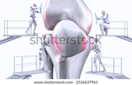 A team of small robots is performing a precise surgical procedure on a human knee joint. Damaged cartilage, arthrosis, knee bone repair. Advanced AI technology joint restoration, implant, surgery. 3D