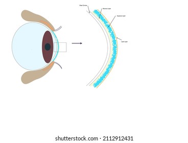 Tear Film Exploded Labelled Diagram