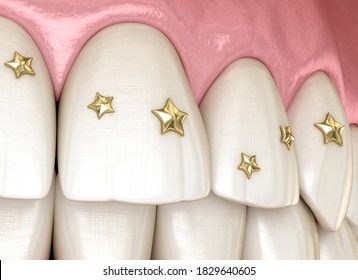 Teeth decoration with golden jewelry, 3D illustration concept.