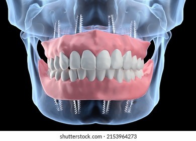 635 3d mouth xray Images, Stock Photos & Vectors | Shutterstock