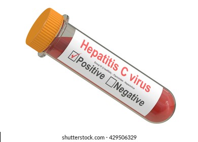 a hepatitis C s a pikkelysmr kezelsre