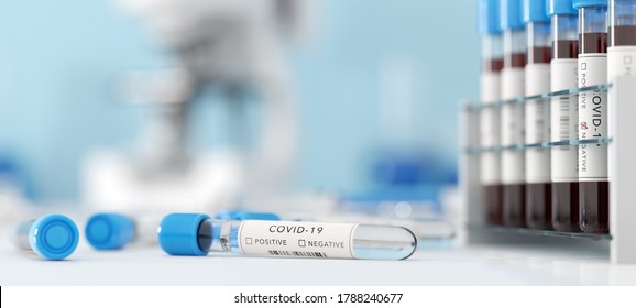 Testing For Coronavirus Covid-19 In A Lab. Medical Screening And Covid Tests Production. 3D Illustration