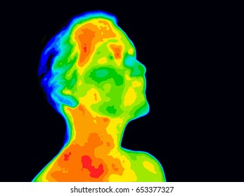 Thermographic image of human face and neck showing different temperatures in range of colors from blue cold to red hot. Red in neck might indicate raised CR-P levels and Carotid Artery inflammation.