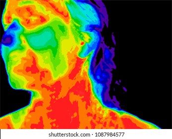 Thermographic image of left side of face of a woman with her head tilted and her neck visible showing different temperatures in range of colors from blue showing cold to red showing hot, inflammation.