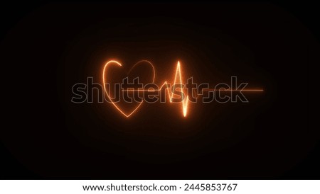 This is an electrical activity of heart. Which is demonstrated by electrocardiogram. This activity can show various type of disease of heart.