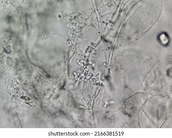 This Pseudohyphae Buddy Yeast Cell By Stock Illustration 2166381519 ...