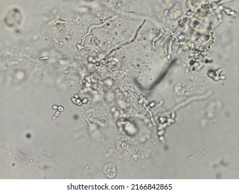 This Pseudohyphae Buddy Yeast Cells By Stock Illustration 2166842865 ...