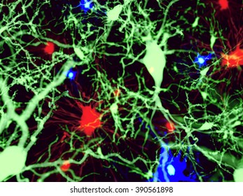 Three types of brain cells.
Red: astrocytes, green: pyramidal neurons, blue: microglia cells,