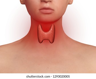 Thyroid Gland Exposed On The Neck Of A Woman With Endocrine Disruption, Inflammation And Swelling. Endocrine System Disease. 3D Illustration