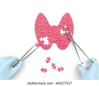 Thyroid puzzle concept: hands of surgeon with surgical instruments (tools) performs thyroid surgery as a result of hypothyroidism, thyroid adenoma, thyroadenitis, euthyroid goiter, iodine deficiency